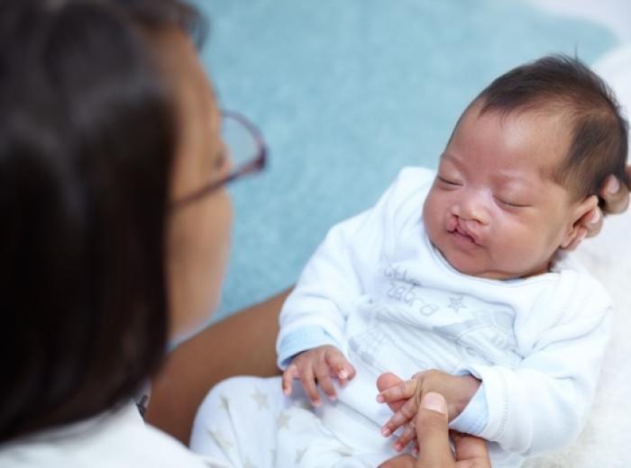 July is National Cleft Lip & Cleft Palate Awareness Month